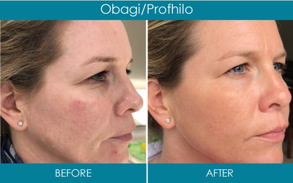 ranelagh dental clinic facial aesthetics obagi skin restoration treatment